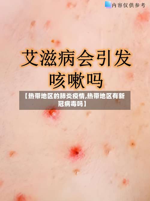 【热带地区的肺炎疫情,热带地区有新冠病毒吗】-第3张图片